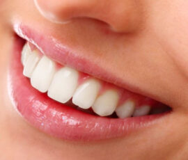 smile ready copertura dentale